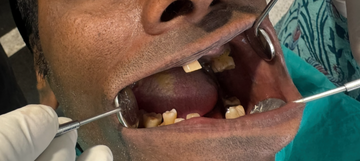 Before Treatment