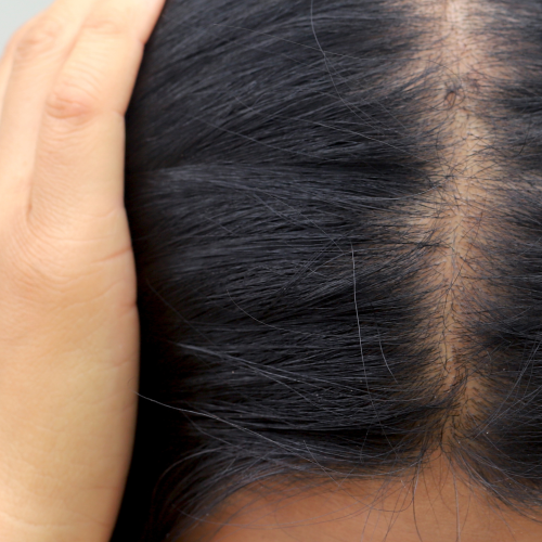 PRP & GFC Therapy vertical 2