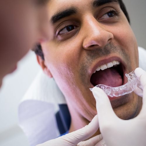 Dentist assisting a patient to wear orthodontic silicone invisible braces