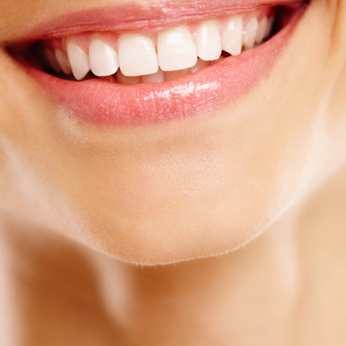 venners and laminates