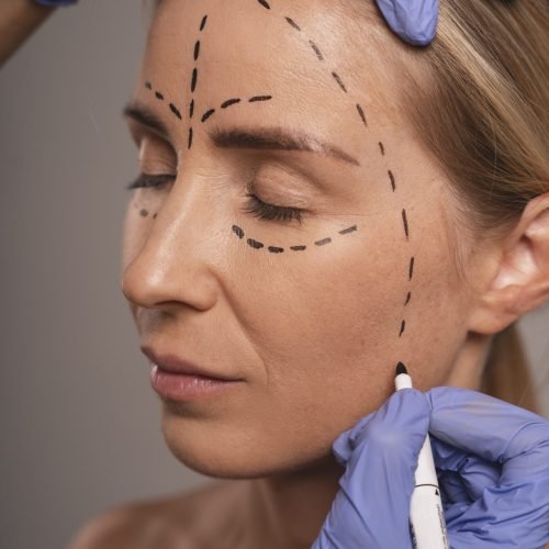 woman-preparing-cosmetic-surgery